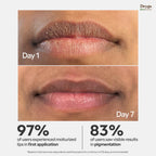 Deyga Beetroot Lip Balm | Lip Care | For Dry & Chapped Lips | For Pigmented Lips | For Women & Men (Classic Lip Balm - Pack of 1)