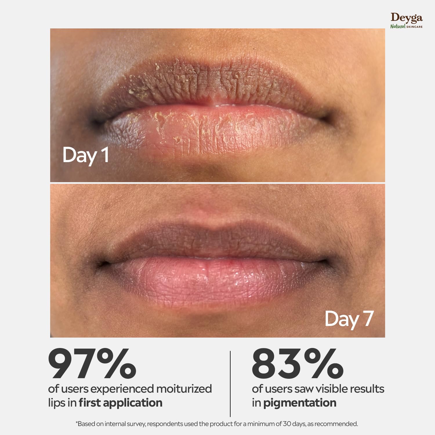 Deyga Beetroot Lip Balm | Lip Care | For Dry & Chapped Lips | For Pigmented Lips | For Women & Men (Classic Lip Balm - Pack of 1)