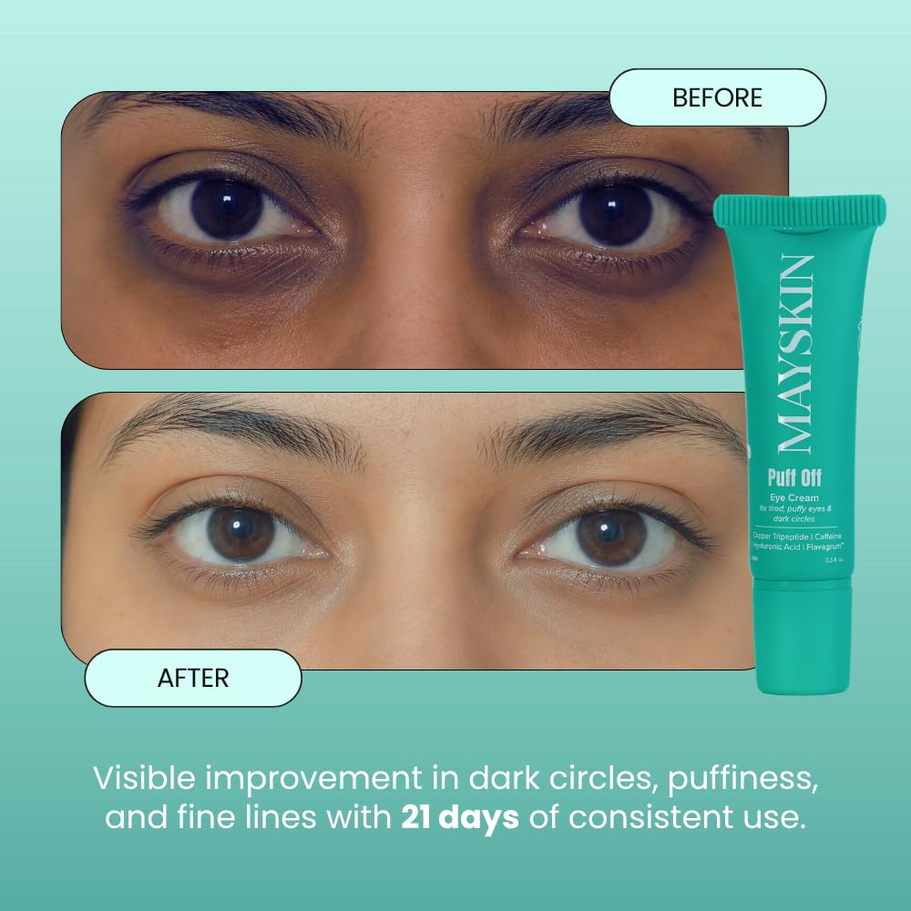 Mayskin Puff Off Eye Cream – Retinal, Copper Peptides & Caffeine for Dark Circles, Puffiness & Fine Lines | Bifida Ferment Lysate & 7 Botanicals...