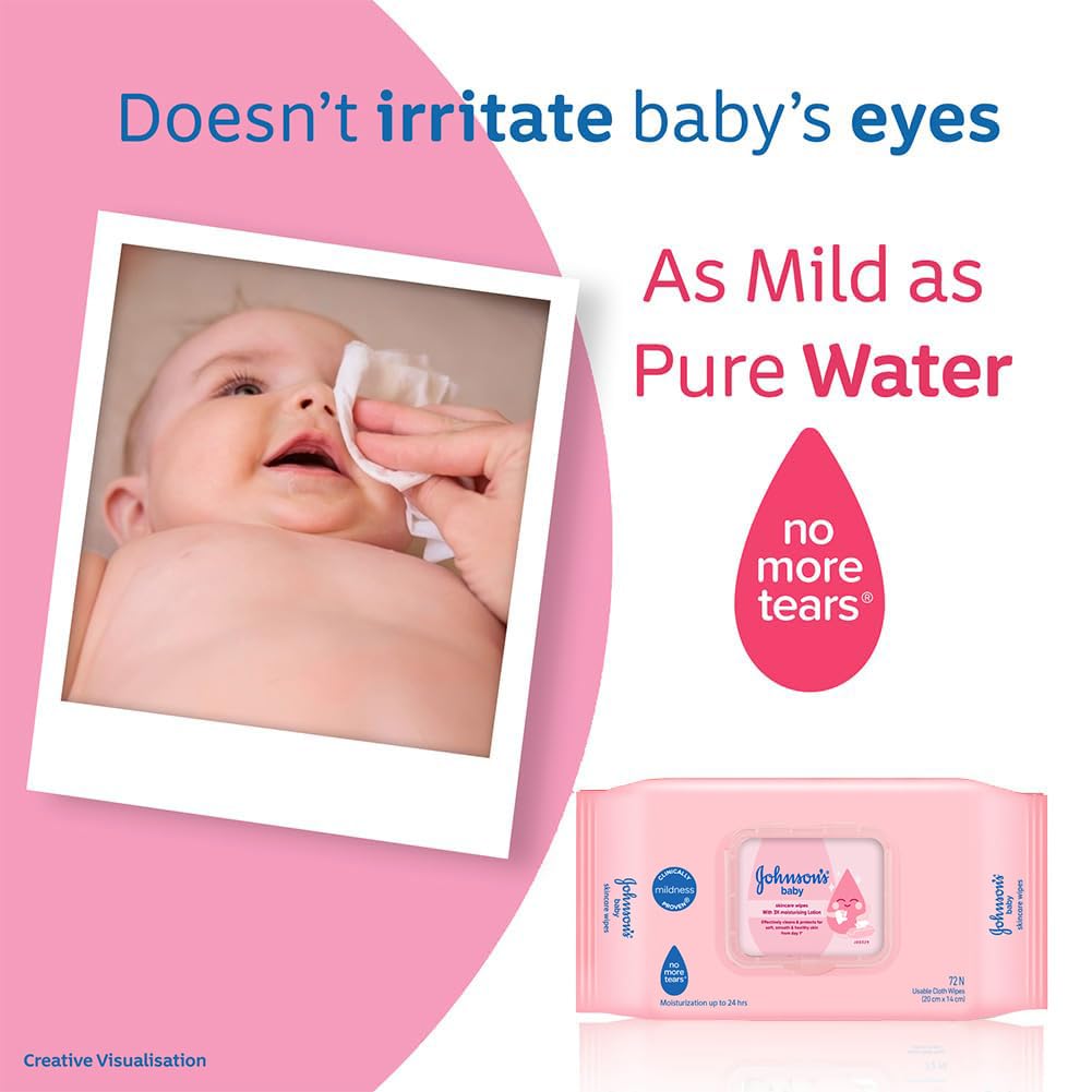 Johnson's Baby Wet Wipes | 72 Wipes | Alcohol & Soap Free | Prevents Rashes & Redness | with 3X Moisturising Lotion | As Mild as Pure Water
