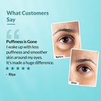 Fixderma Under Eye Cream Roll on with Peptides, Green Tea Extract & Vitamin E | Reduces Dark Circles, Puffiness, Wrinkles & Fine Lines | Triple...