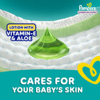 Pampers Complete Skin Comfort Pants, (M) 76 Count, Anti-rash blanket, Lotion with Vitamin E & Aloe Vera, Medium, 7-12kg