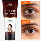 INTIMIFY Under Eye Cream, Dark Circles Removal Cream, Under Eye Cream For Dark Circles & Wrinkles 20 Gm (Pack of 1)