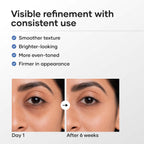 Cureskin Vitamin K + Retinol 0.1% Under Eye Cream | Reduces Dark Circles, Puffiness & Fine Lines | With Collagen Peptides | Night Cream for Women &...