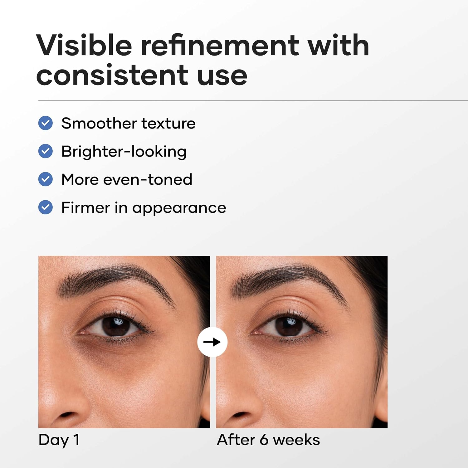 Cureskin Vitamin K + Retinol 0.1% Under Eye Cream | Reduces Dark Circles, Puffiness & Fine Lines | With Collagen Peptides | Night Cream for Women &...