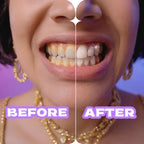 Close Up White Now Stain Eraser toothpaste for Teeth Whitening 100 gram