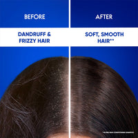 Head & Shoulders 2-in-1 Smooth and Silky Anti Dandruff Shampoo + Conditioner ( 1 L)