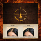 Indulekha Bringha Oil 250 ml