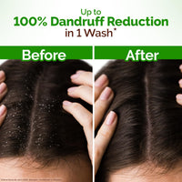 Mamaearth Lemon Anti-Dandruff Shampoo with Lemon 600 ML