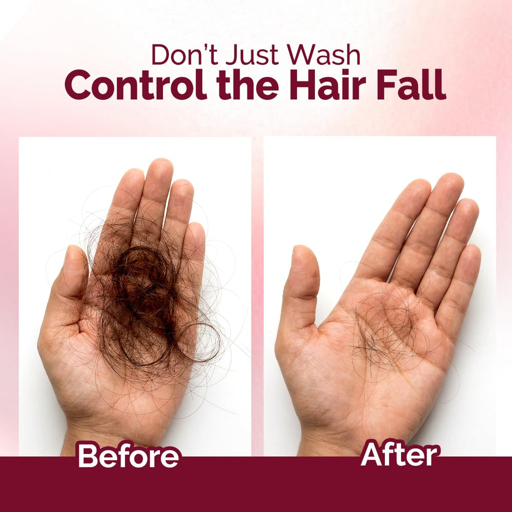 Mamaearth Onion Shampoo for Hair Growth and Hair Fall Control with Onion 600 ml