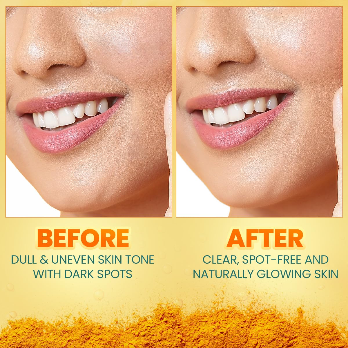 Himalaya Dark Spot Clearing Turmeric Face Serum, 30 mL