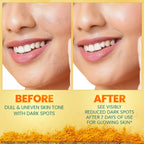 Himalaya Dark Spot Clearing Turmeric Face Serum, 30 mL