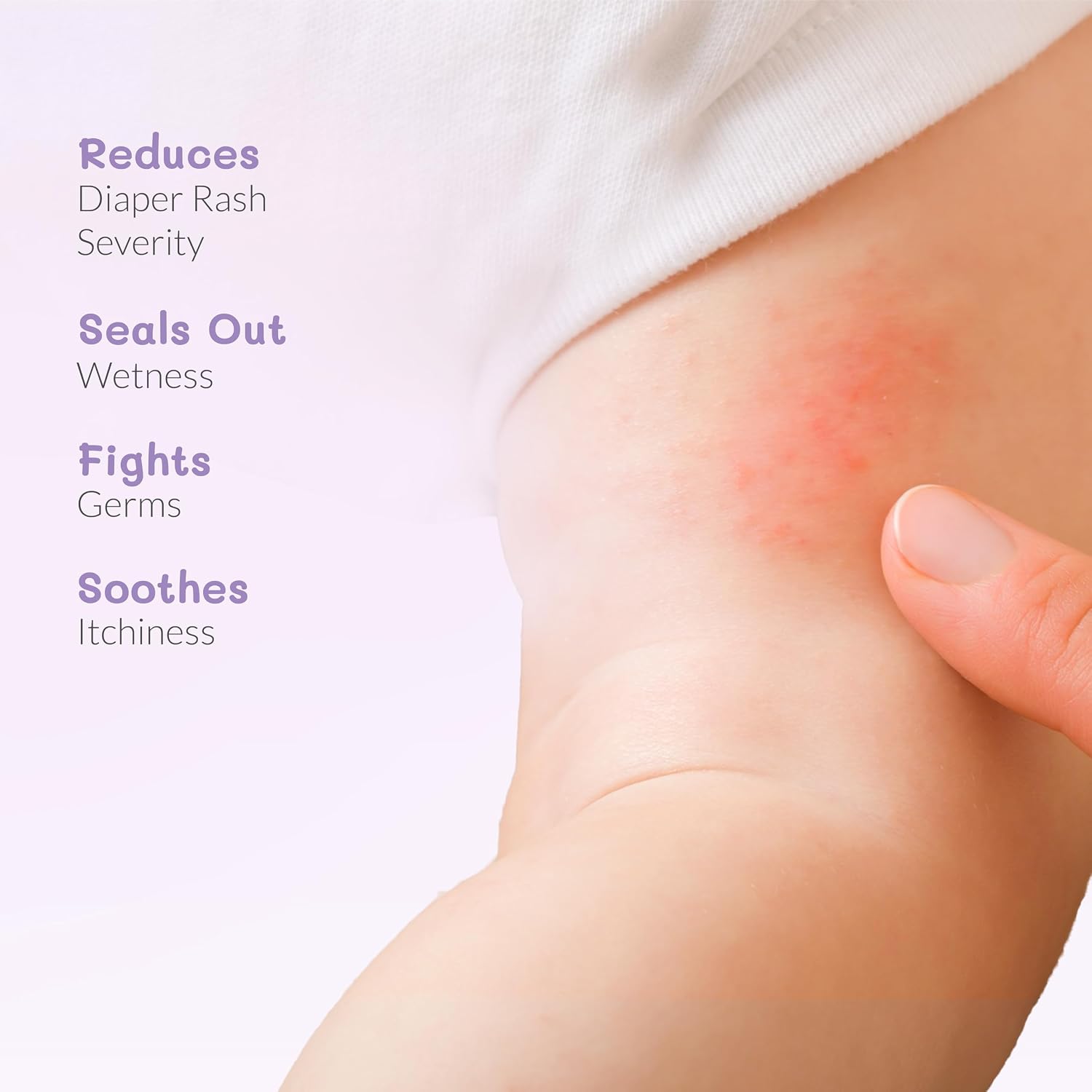 AreoVeda Diaper Rash Cream (50 gm),