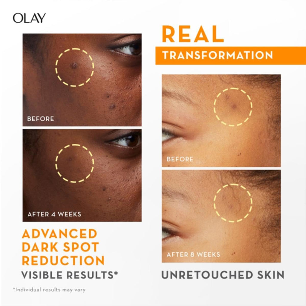Olay Vitamin C Kit for 2X Glow