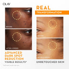 Olay Vitamin C Kit for 2X Glow