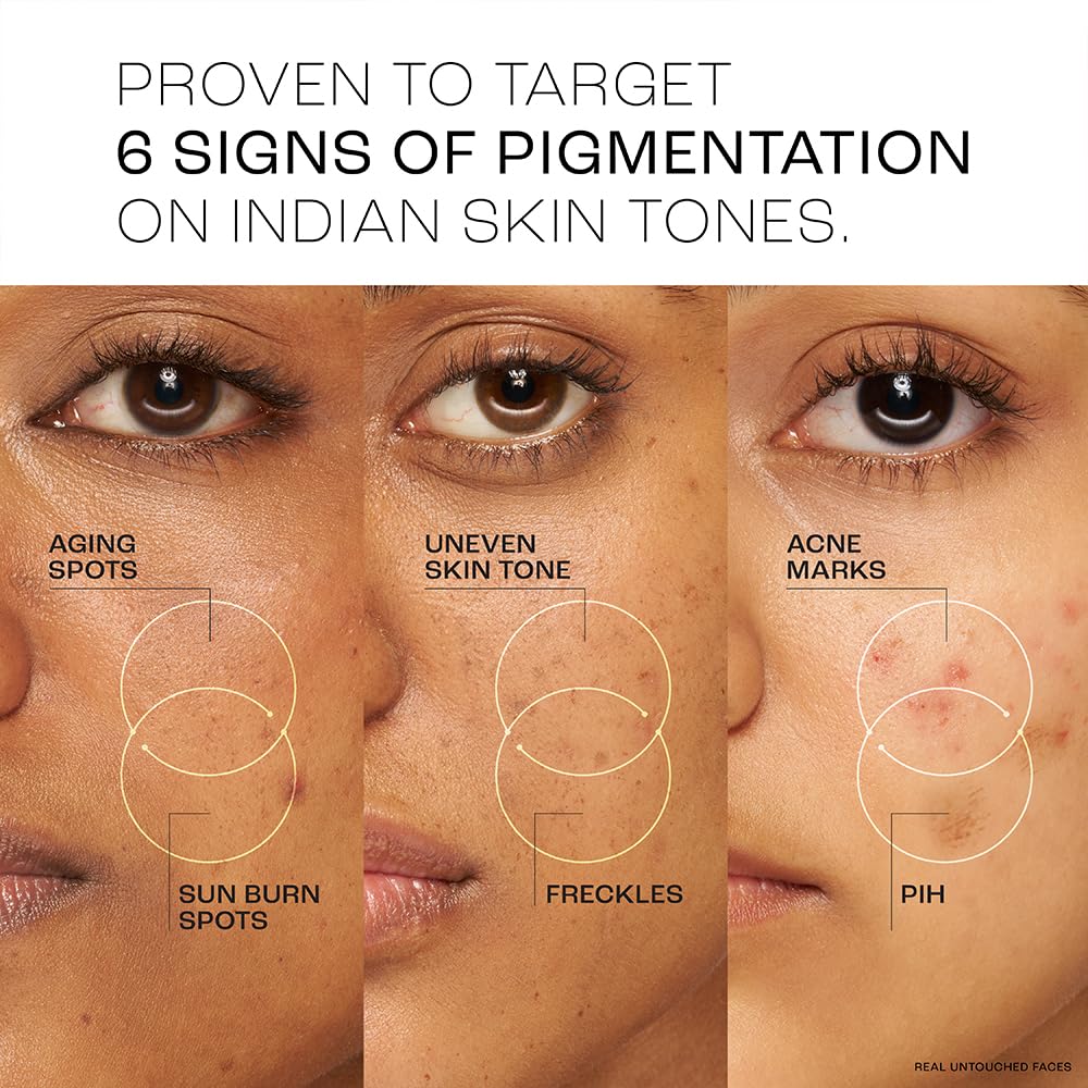 Lakme Perfect Radiance Pigmentation Treatment Gel